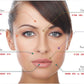 For Deep Wrinkles Lip Plumping Hyaluronic Acid Filler Lip Injection
